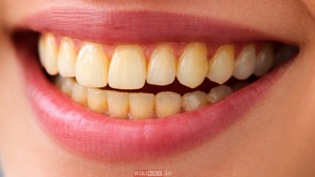 Yellow teeth visible even after daily brushing, showing natural tooth discoloration